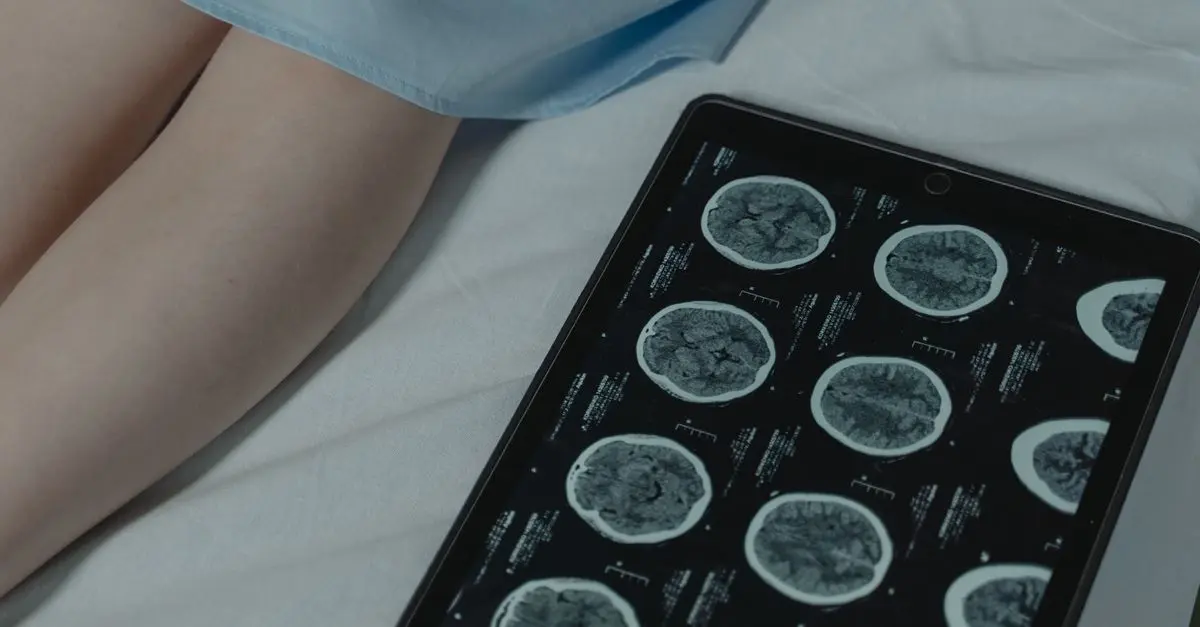 L'interface cerveau-machine : une avancée révolutionnaire